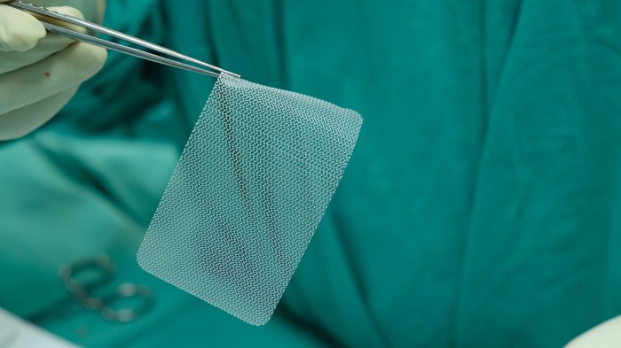 Hernia mesh lawsuit attorneys near me